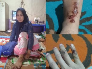 Safitri Salah Seorang Korban Tiang Listrik Tumbang Minta Bertanggung Jawab PT PLN (Persero)