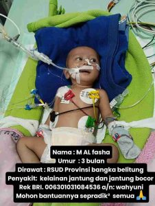 Yo Pradiek, Mun ade Rezeki Kita Bantu Adek Bayi Operasi Jantung RS Harapan Kita Jakarta