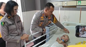 Polres Pelabuhan Makassar Selamatkan Bocah dengan Tubuh Penuh Luka Bakar