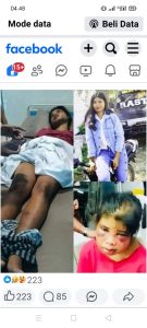 Viral Foto-Foto Di Media Sosial Asisten Rumah Tangga, Dugaan Di Siksa Oleh Majikan-nya.