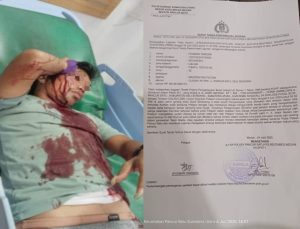 Terduga, Pelaku Penganiayaan Dan Pembacokan, Kini Telah Di Bebaskan Oleh Polsek Pancur Batu.