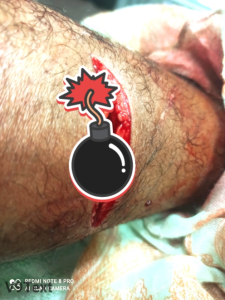 Aksi Penyerangan di Desa Ketaren Kabanjahe: Warga Jadi Korban, Tiga Pelaku Bersenjata Tajam Ditangkap