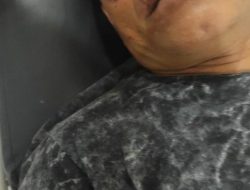 Keluarga Korban Penganiayaan Brutal, Di Manggarai : “6 Bulan Menanti Keadilan, Pelaku Masih Bebas Berkeliaran”.